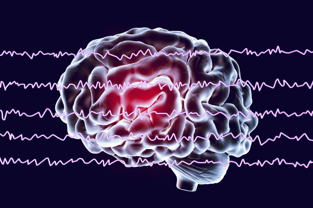 Eeg Brain Mapping Cost