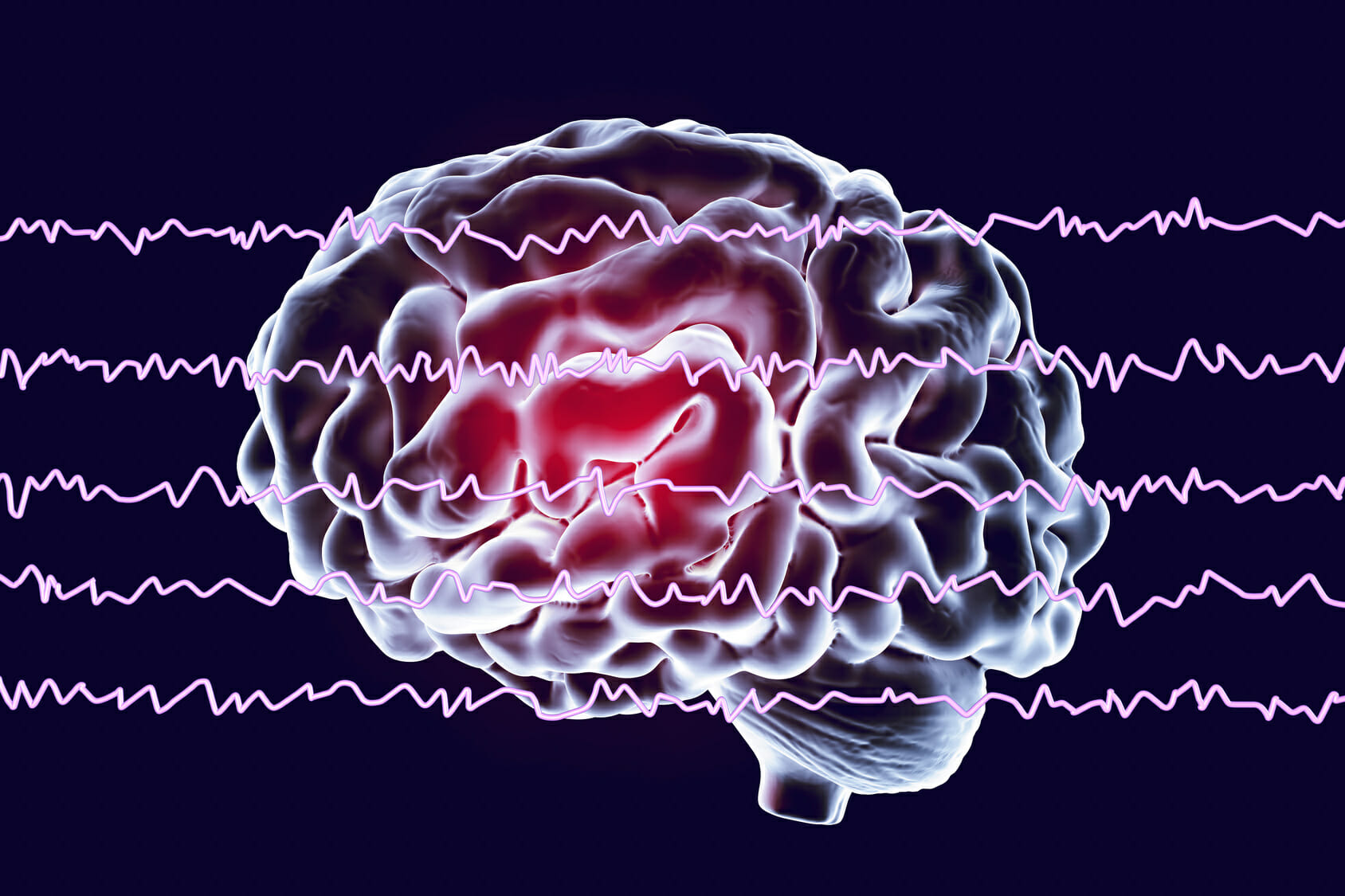 eeg brain scan