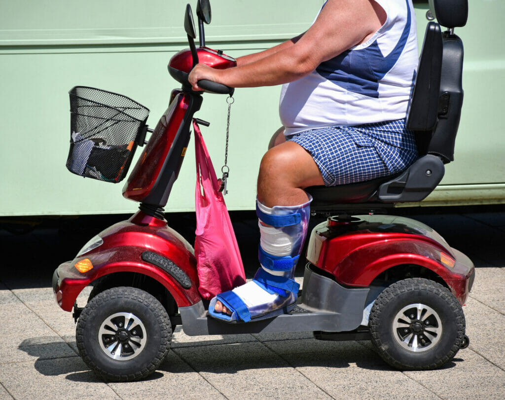 Obese Man In electric wheelchair Image